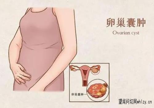 卵巢囊肿月经延期10天量少经前腹胀吃什么中药能治好？