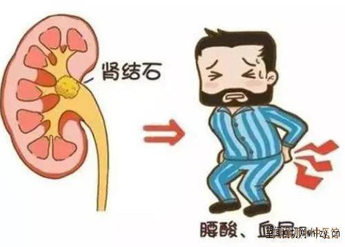 武汉中医李家发教授：肾结石阵发性左侧腰部隐痛血尿痛吃什么中药能打下来？