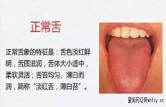 中医诊断学中望诊之舌诊的辨苔关于苔质和苔色的概述和学习要点