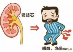 武汉中医李家发教授：肾结石阵发性左侧腰部隐痛血尿痛吃什么中药能打下来?