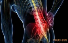 骨病康复专家熊勇：腰椎间盘突出腰臀部疼痛逐渐加重中医针灸怎么治疗？